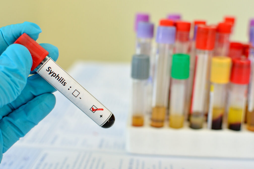 A gloved hand holds a test tube labeled 'Syphilis' with a positive result checkmark, in front of a rack of various other blood samples in tubes capped with different colors.